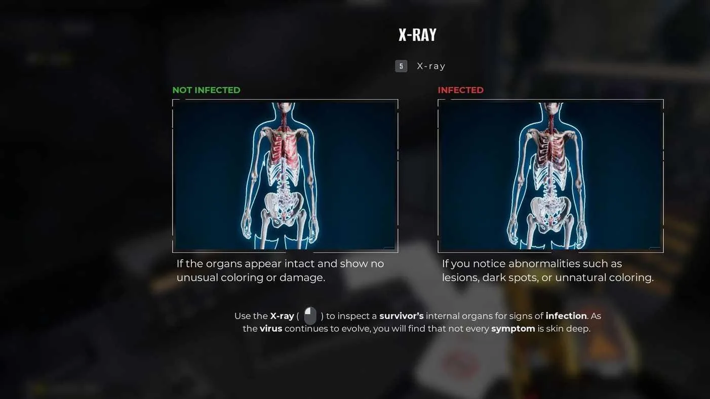 How to Use the X-Ray in Quarantine Zone The Last Check