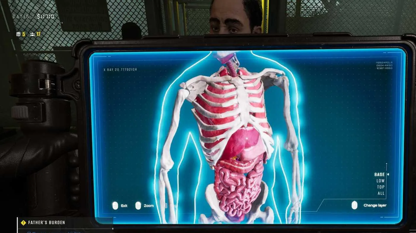 How to Use the X-Ray in Quarantine Zone The Last Check