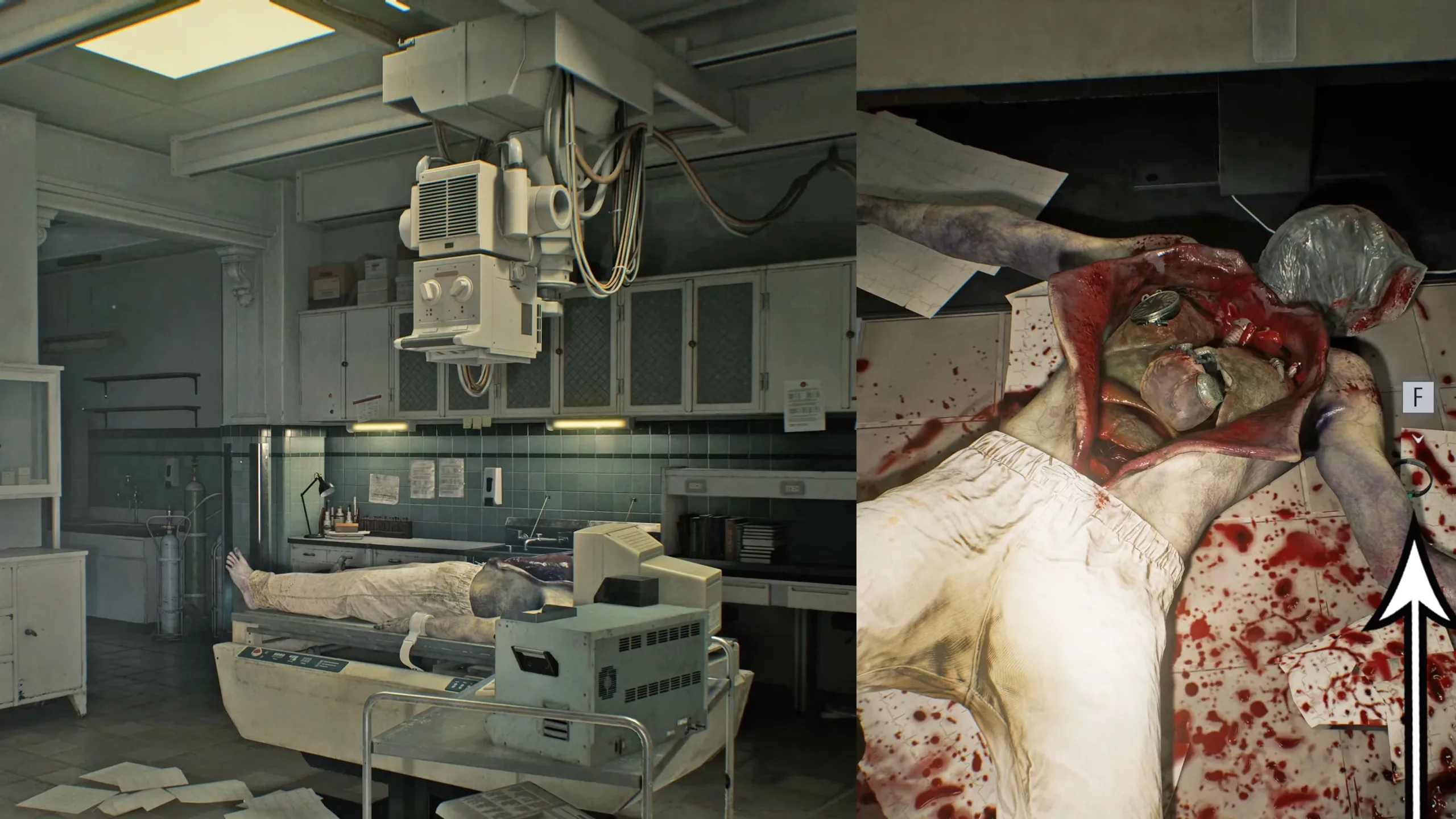 Resident Evil Requiem walkthrough part 5: Garage, Isolation Ward, and the Attic in the Chronic Care Center